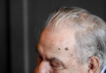 뇌 건강과 치매 예방을 위한 중요한 습관들 man holding chin